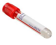 BD Vacutainer 2 ml muovinen seerumiputki punainen