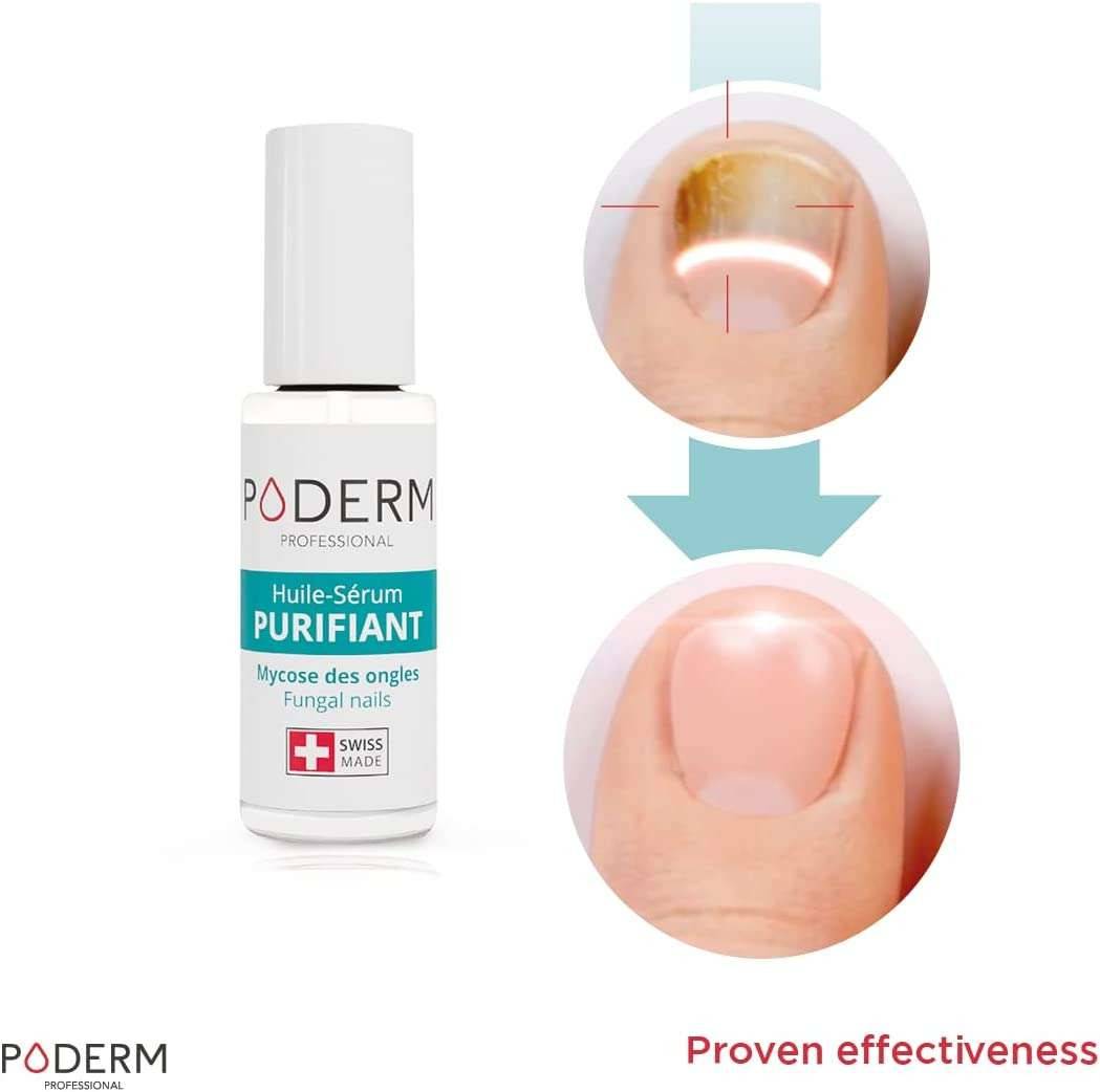 Poderm - Poderm Fungal Nails - 1-HSP-O-PIN-8 UKMEDI.CO.UK UK Medical Supplies